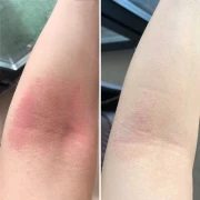 H_P_BEFORE-AFTER_2.webp
